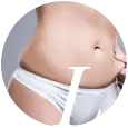 liposuction